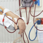 Hemodiálise para Enfermeiros | ONLINE | Fevereiro 2023